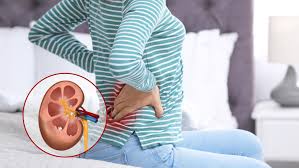 Best Kidney Stone Hospital in Jaipur